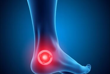 【3RE Health 專屬｜筋膜刀治療：深層釋放・重塑肌肉平衡】